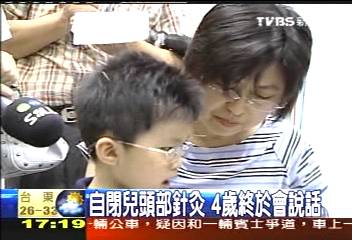 自閉兒頭部針灸 4歲終於會說話