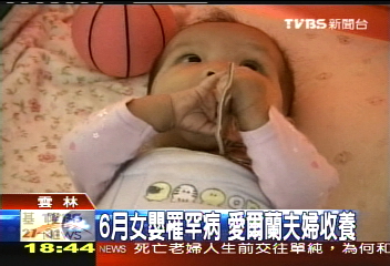 6月女嬰罹罕病 愛爾蘭夫婦收養