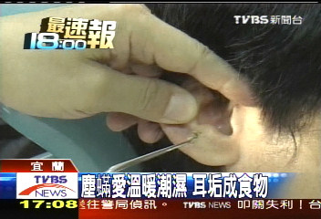 耳朵好癢! 7隻塵螨耳膜作祟