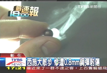 西施犬散步 慘遭0.8mm鋼彈射傷