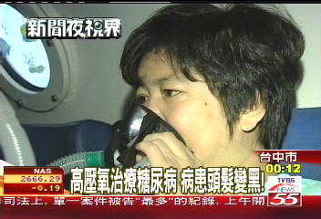 高壓氧治療糖尿病 病患頭髮變黑!
