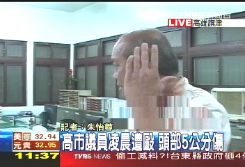 高市議員遭毆 頭部5公分撕裂傷