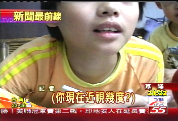 罕見馬凡氏症　小五近視2千度