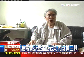 為電費少妻痛毆老夫　門牙掉3顆