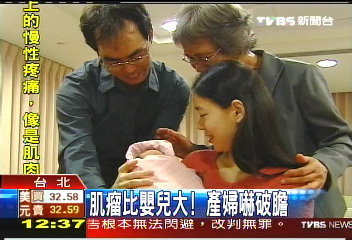 肌瘤比嬰兒大 產婦嚇破膽