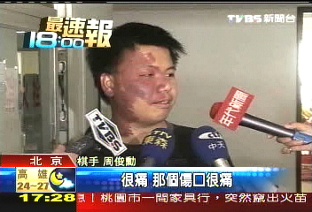 紅面棋王周俊勳 北京參賽前受傷