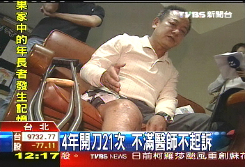 接骨變長短腳 病患求償769萬