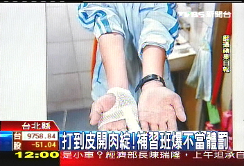 打到皮開肉綻! 補習班爆不當體罰