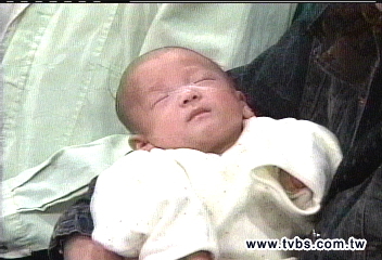 全國最輕早產兒 僅395公克重