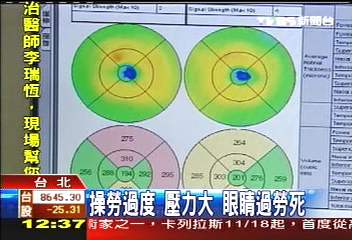 操勞過度、 壓力大 眼睛過勞死