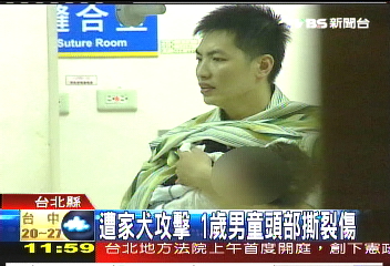 遭家犬攻擊 1歲男童頭部撕裂傷