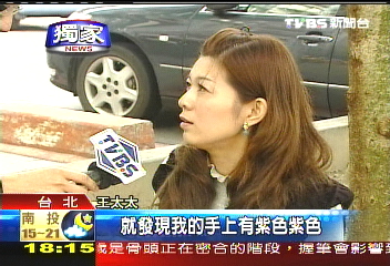 〈獨家〉週年慶狂血拚! 貴婦手上長怪斑