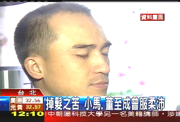 受掉髮之苦 小馬、董至成曾服柔沛