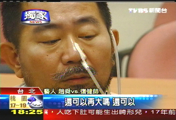 〈獨家〉盼找回吞嚥功能 趙舜喉嚨通電