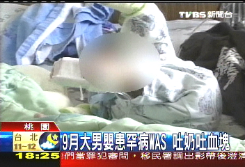 9月大男嬰患罕病WAS　吐奶吐血塊