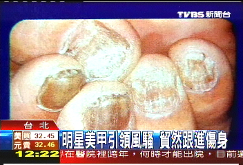 明星美甲引領風騷 貿然跟進傷身
