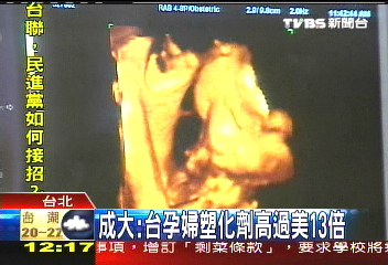 成大：台孕婦塑化劑高過美13倍
