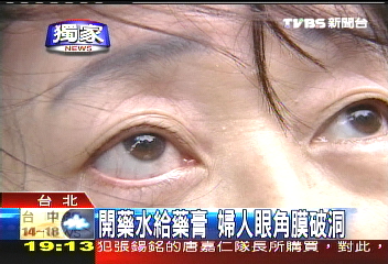 〈獨家〉開藥水給藥膏　婦人眼角膜破洞