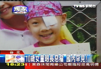 〈獨家〉10歲女童眼長惡瘤 國內罕見!