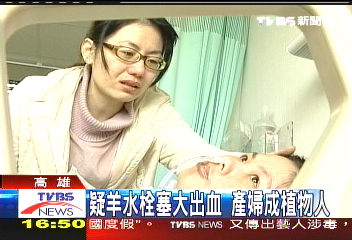 疑羊水栓塞大出血 產婦成植物人