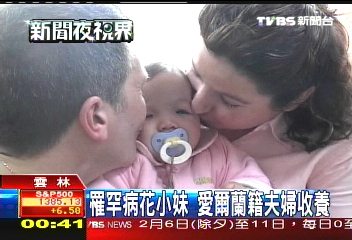 罹罕病花小妹 愛爾蘭籍夫婦收養