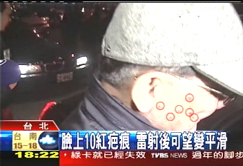連爺爺也愛美！　年前做「臉部」小美容