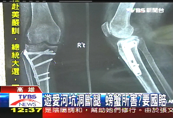 遊愛河坑洞斷腿 螃蟹所害?要國賠