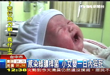 感染綠膿桿菌　小女嬰1日內猝死