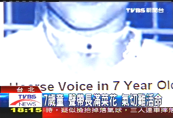 7歲童聲帶長滿菜花　氣切難活命