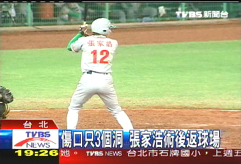 中華職棒／傷口只3個洞　張家浩術後返球場
