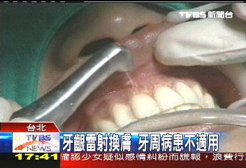 還黑牙齦「清白」　座艙長開口大笑