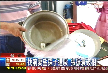 找兒子! 張振寰遭圍毆頭縫10針