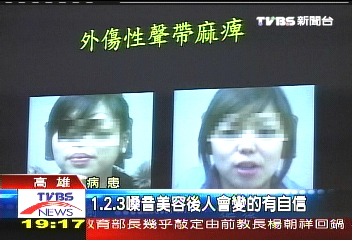 嗓音美容找回聲音　甜美聲不是夢