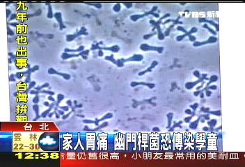 1成學童染幽門桿菌　恐影響發育