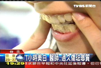 給我「裴帥」笑 美白牙齒貼片攻台