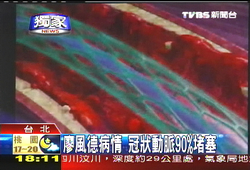 風德猝逝／〈獨家〉廖風德病情　冠狀動脈90%堵塞