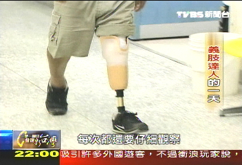 【一步一腳印】許福財妙手仁心 重啟傷患一片天(上)