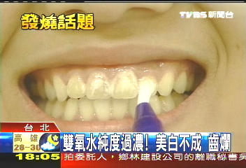 美白齒危機! 臨床:當心神經壞死