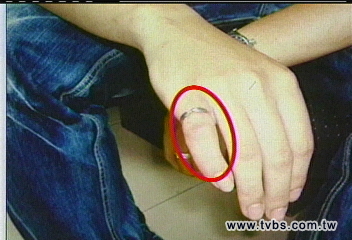 糗大！尾戒卡小指　男子硬套拔不出