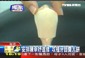 〈獨家〉安排陳幸妤進修　攻植牙自費大餅