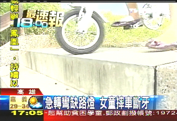 急轉彎缺路燈 女童摔車斷牙
