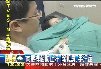 肉毒桿菌助止汗 除狐臭、手汗症