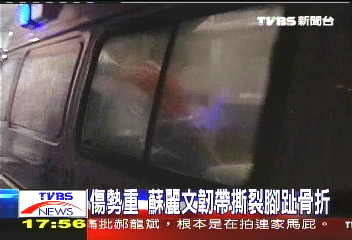 傷勢重　蘇麗文韌帶撕裂腳趾骨折