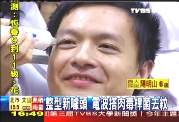整型新噱頭　電波搭肉毒桿菌去紋