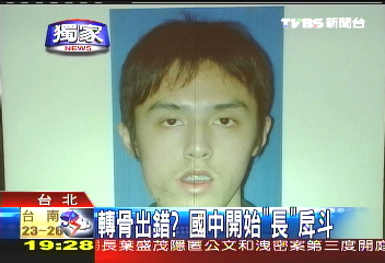 〈獨家〉轉骨出錯? 國中開始「長」戽斗