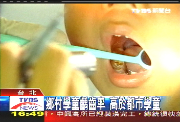 鄉村學童齲齒率 高於都市學童