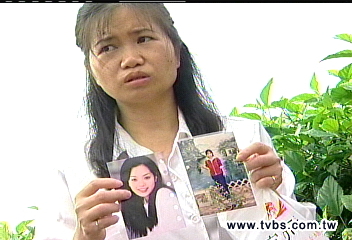 矯正牙齒不像蔡琳 女子求償敗訴