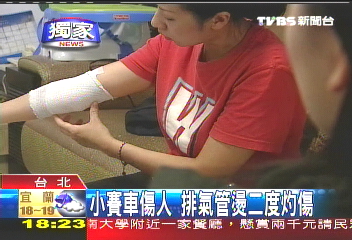 〈獨家〉小賽車傷人　排氣管燙二度灼傷