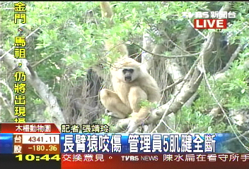 白手長臂猿咬傷 管理員5肌腱斷