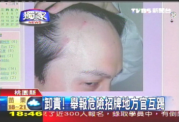 〈獨家〉卸責! 舉報危險招牌地方官互踢